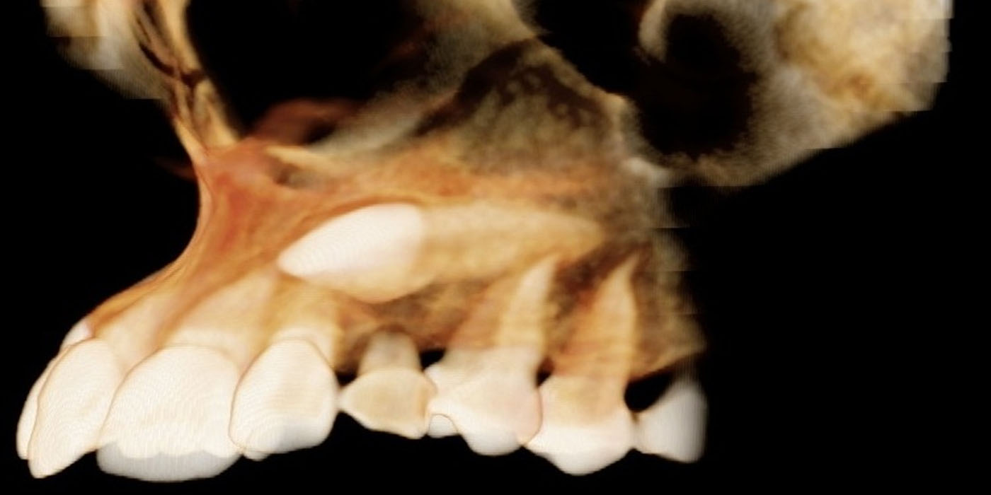 Quadrant Scan / Sectional Scan
