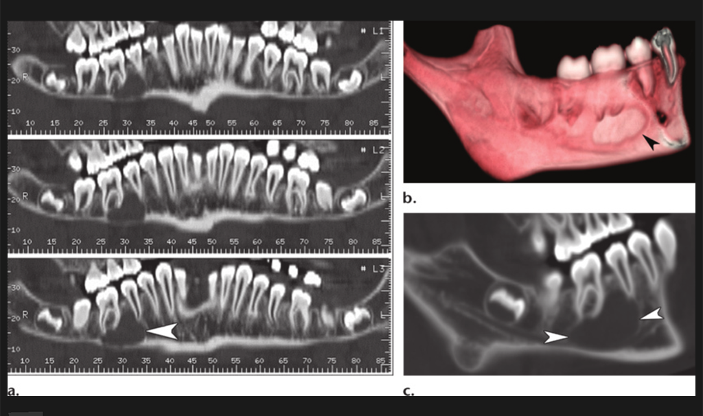 quadrant-sectional-scan